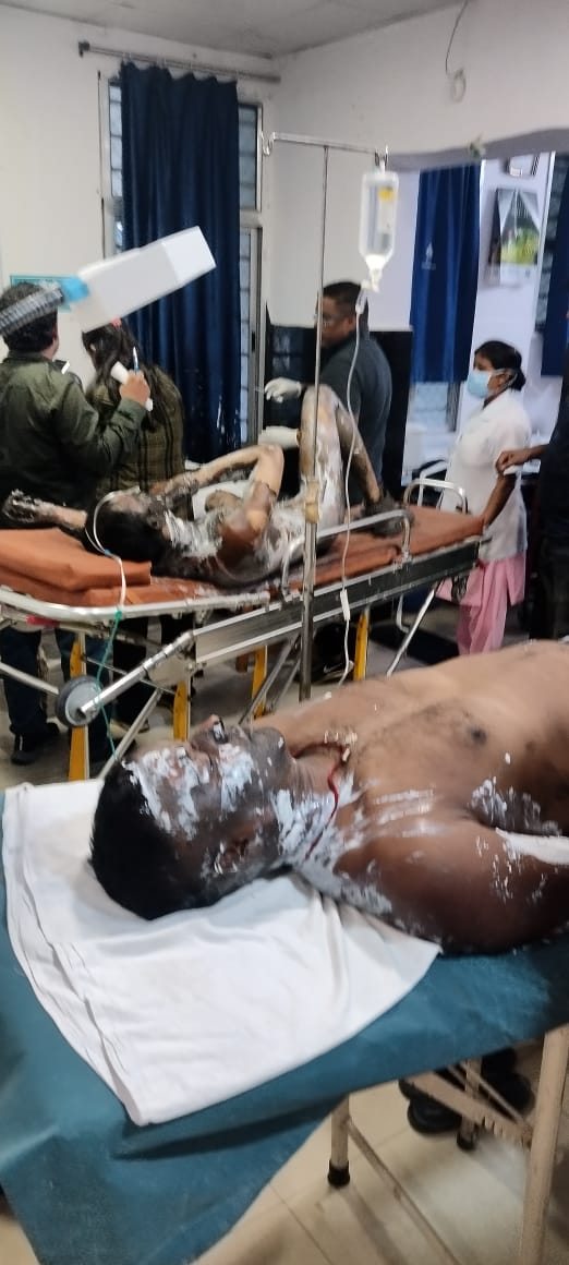 बोकारो स्टील प्लांट में बड़ा हादसा, तीन मजदूर गंभीर रूप से झुलसे