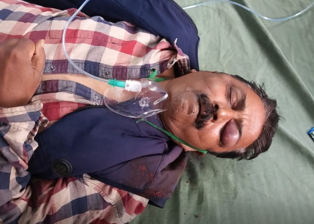 हजारीबाग सड़क हादसा: कोयला लदे ट्रक ने स्कूटी और टोटो को मारी जोरदार टक्कर, एक गंभीर, रिम्स रेफर