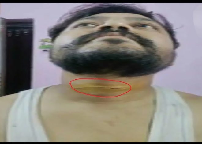 रांची में चाइनीज मांझे का कहर, ओवरब्रिज पर युवक हुआ घायल…………………..