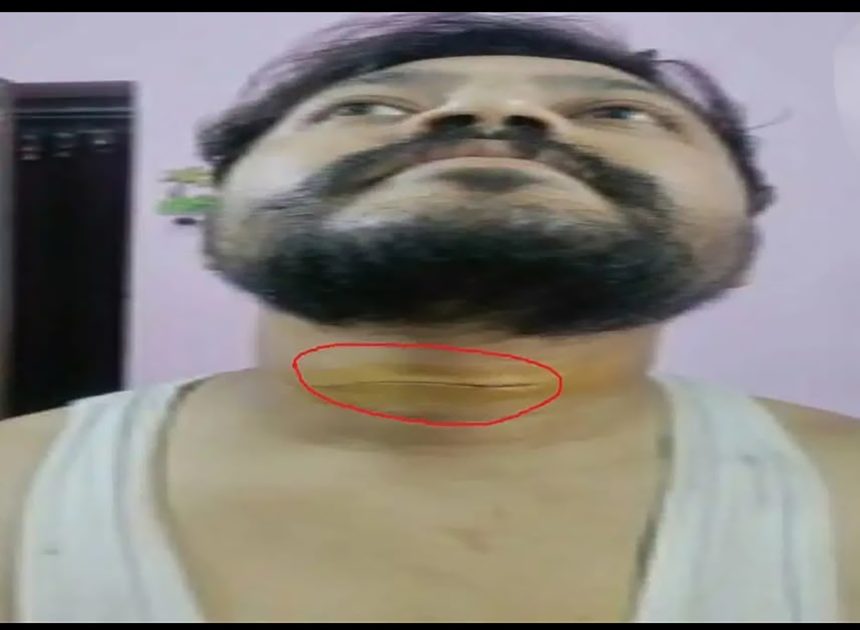 रांची में चाइनीज मांझे का कहर, ओवरब्रिज पर युवक हुआ घायल…………………..
